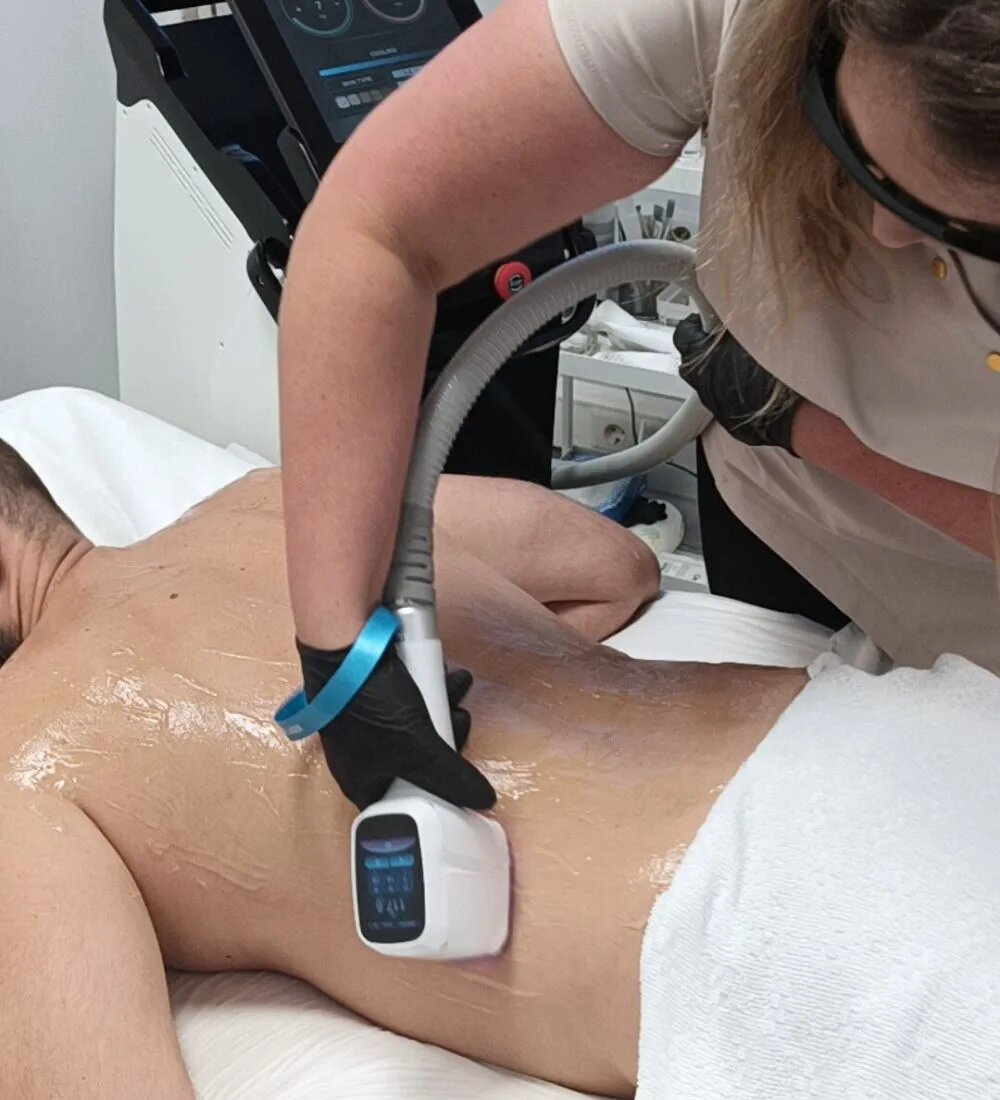 Laserontharing Mannen